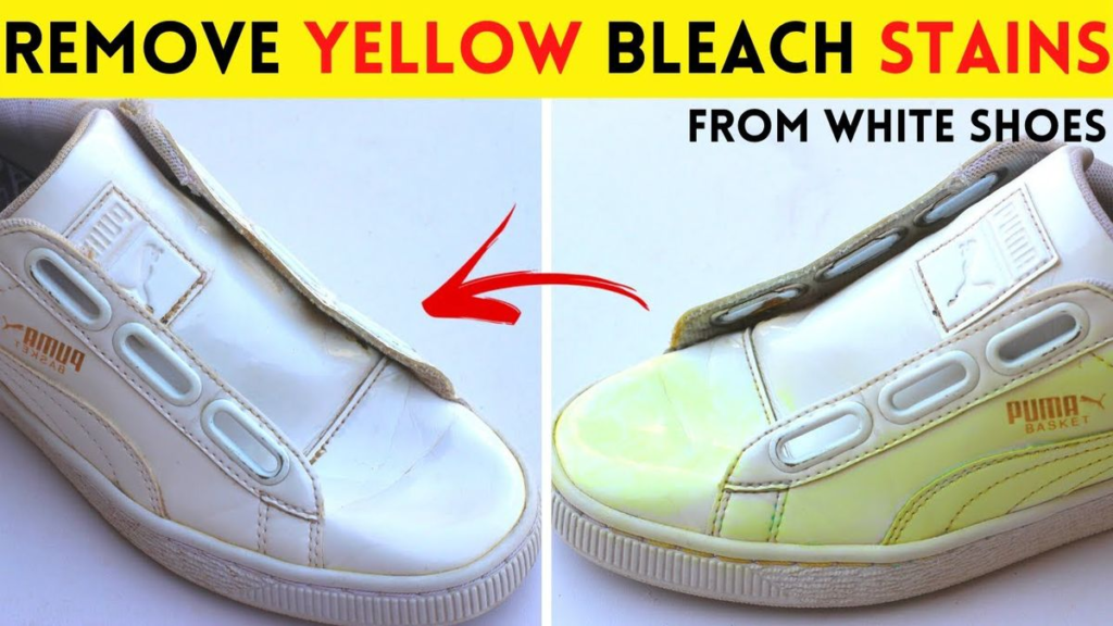 How to remove yellowing from shoe soles?